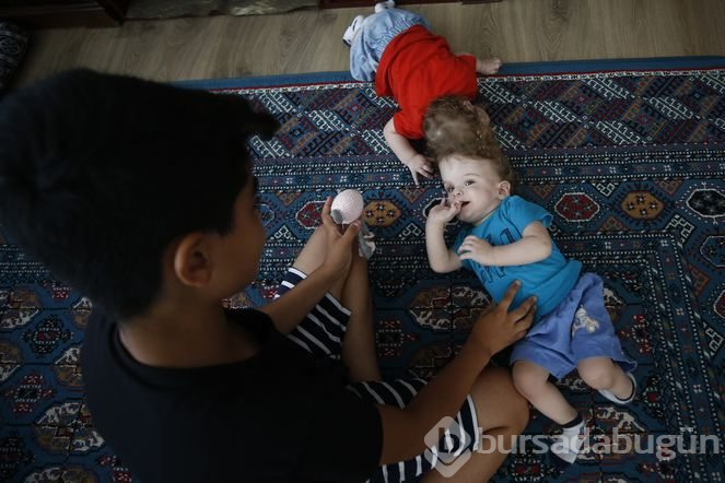 Kafadan yapışık siyam ikizleri Derman ve Yiğit, bir yaşına girdi