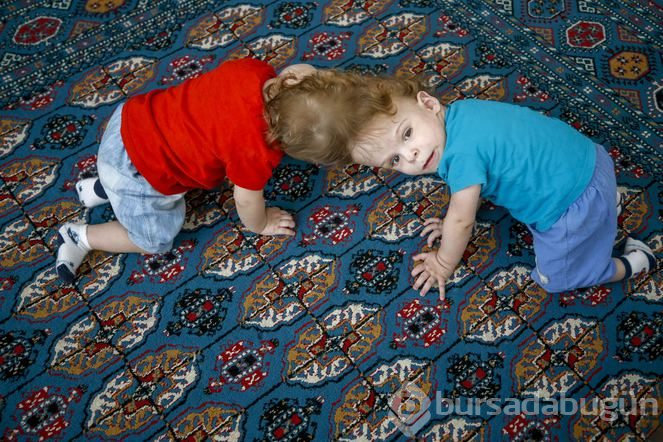 Kafadan yapışık siyam ikizleri Derman ve Yiğit, bir yaşına girdi