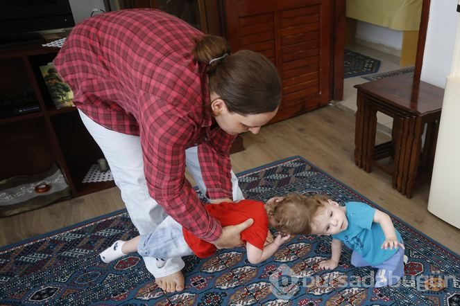 Kafadan yapışık siyam ikizleri Derman ve Yiğit, bir yaşına girdi