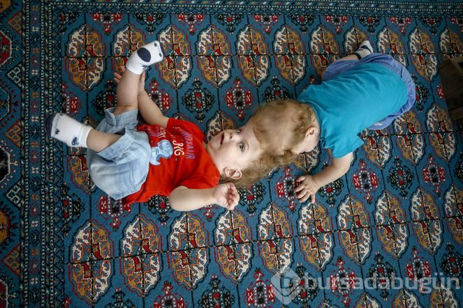 Kafadan yapışık siyam ikizleri Derman ve Yiğit, bir yaşına girdi