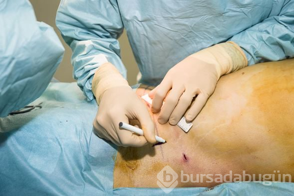 Mide botoksu ile kısa sürede kilo vermek mümkün
