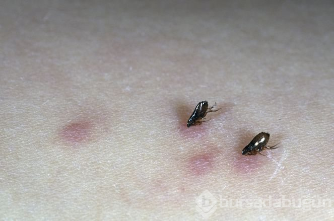 Arı-böcek-sivrisinek sokmalarına karşı alınabilecek 10 önlem