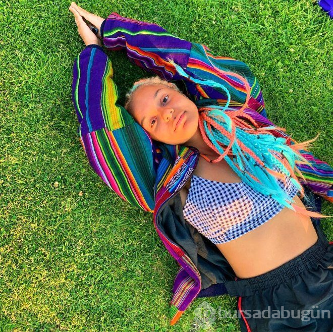 Ünlü Instagram fenomeni, saçlarını düzleştirmek isterken kel kaldı!