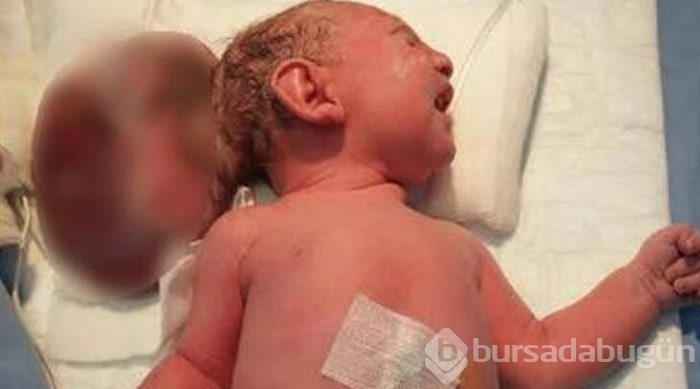 Elif bebek ameliyat edildi