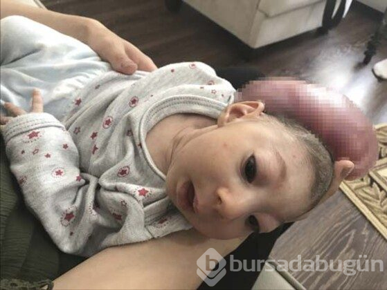 Elif bebek ameliyat edildi