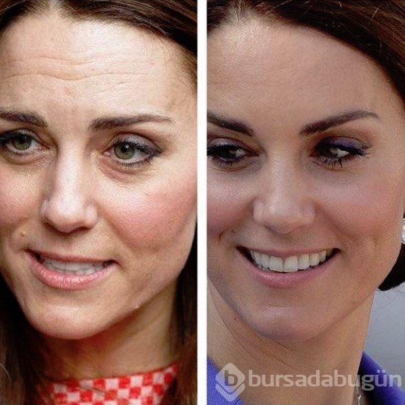 Kate Middleton'ın botoks yaptırdığı iddiasına saraydan yalanlama