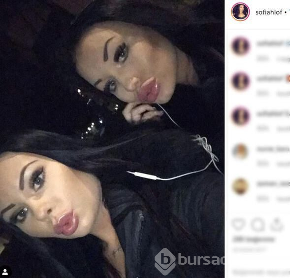 İkiz gibi olmak için bıçak altına yattılar!