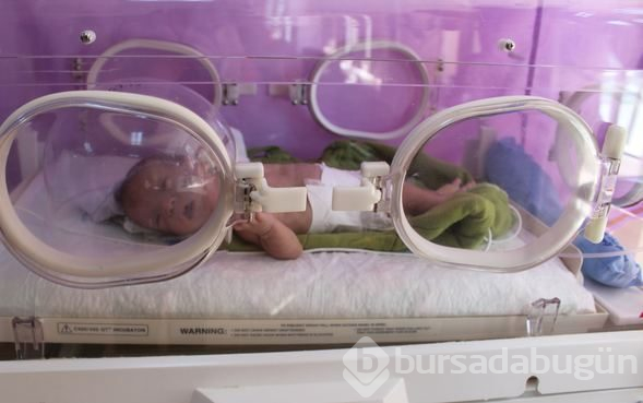 670 gram olarak dünyaya gelen 'parmak bebek' yaşama tutundu