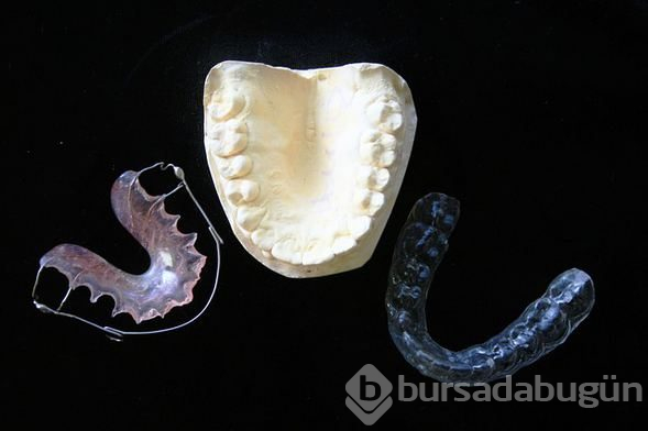 Beklemek zorunda değilsiniz! İşte tüm detaylarıyla hızlı diş teli tedavisi