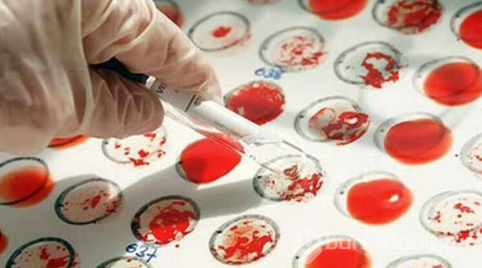 Kansere karşı en dirençli kan grubu açıklandı
