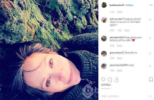 Kansere yakalanan ve 8 ay ömür biçilen oyuncu 3 yıldır hayata tutunuyor: Neden bir mucize olmasın ki!