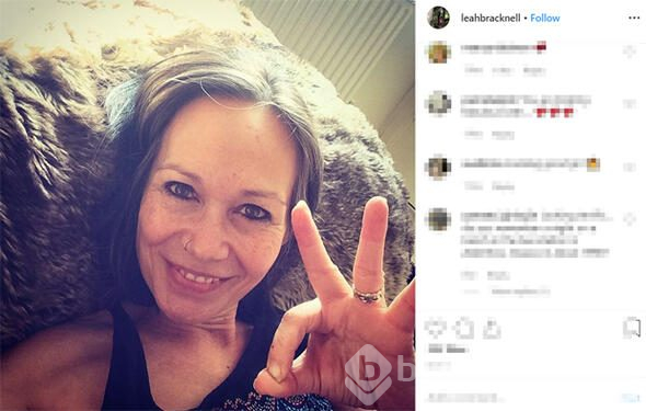 Kansere yakalanan ve 8 ay ömür biçilen oyuncu 3 yıldır hayata tutunuyor: Neden bir mucize olmasın ki!