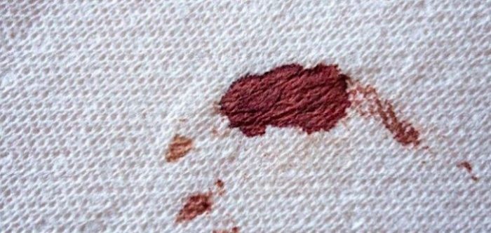 Kurumuş kan lekesi nasıl çıkar?
