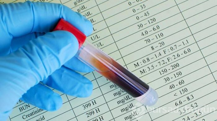Kapalı alanlarda çalışanlarda D vitamini eksikliği tehlikesi
