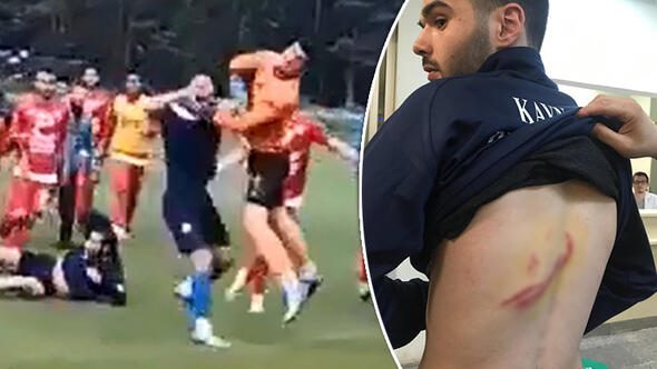 Amatör lig oyuncuları birbirine girdi