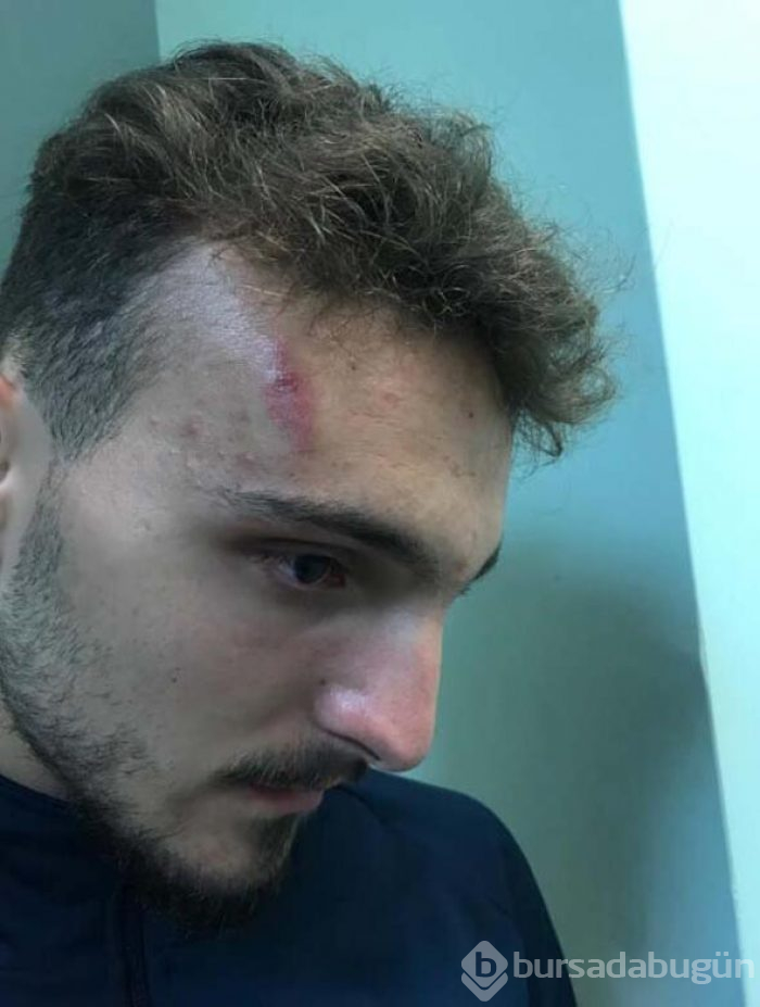 Amatör lig oyuncuları birbirine girdi