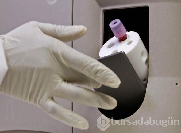 HIV virüsüne çare bulunmuş olabilir