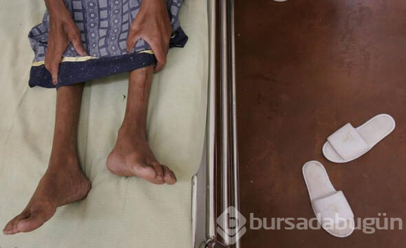 HIV virüsüne çare bulunmuş olabilir