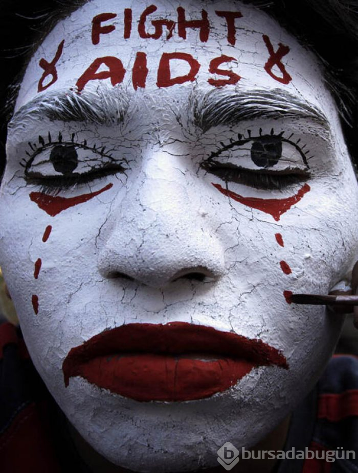 HIV virüsüne çare bulunmuş olabilir