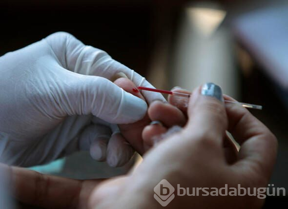 HIV virüsüne çare bulunmuş olabilir