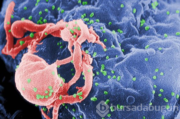 HIV virüsüne çare bulunmuş olabilir