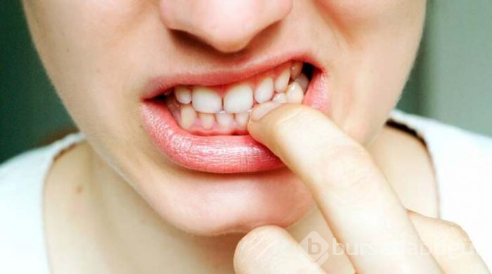 Tırnak yeme alışkanlığı olan insanlarda neler görülür?
