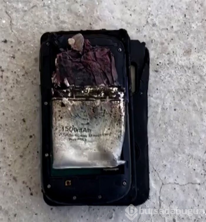 Cep telefonu bacağını parçaladı!
