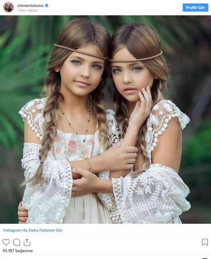 Dünyanın en güzel ikizleri!