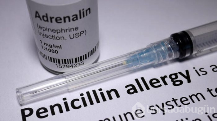 Penisilin alerjisi olduğu nasıl anlaşılır?