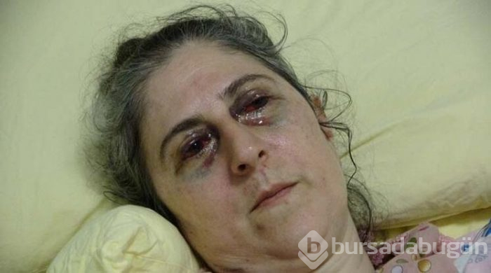 Anne ve kızını arabayla ezdi!
