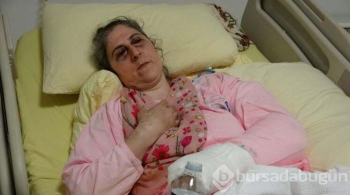 Anne ve kızını arabayla ezdi!