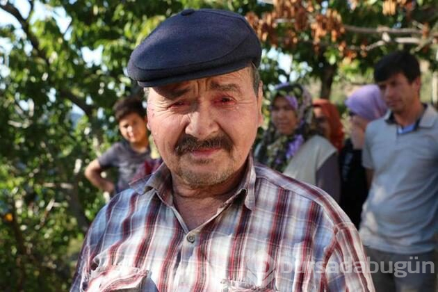 Balık pulu hastalığıyla boğuşuyor!