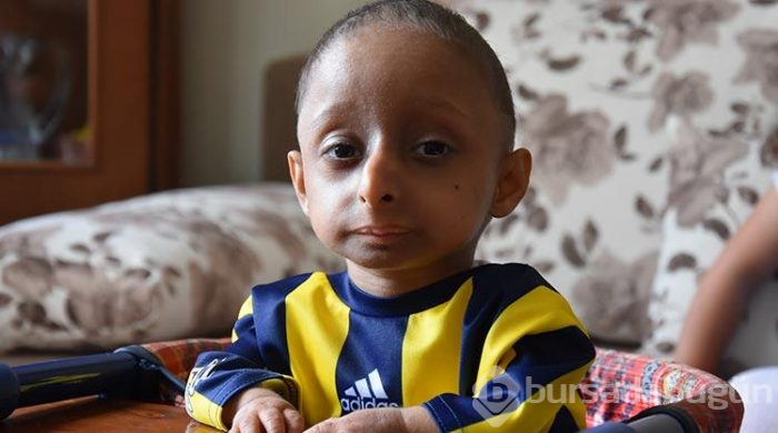 Türkiye'de bu hastalığı bulunan 3 kişi var