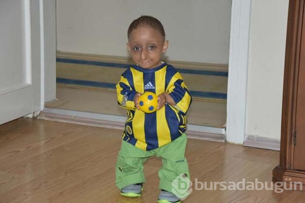 Türkiye'de bu hastalığı bulunan 3 kişi var
