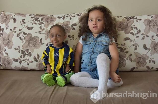 Türkiye'de bu hastalığı bulunan 3 kişi var