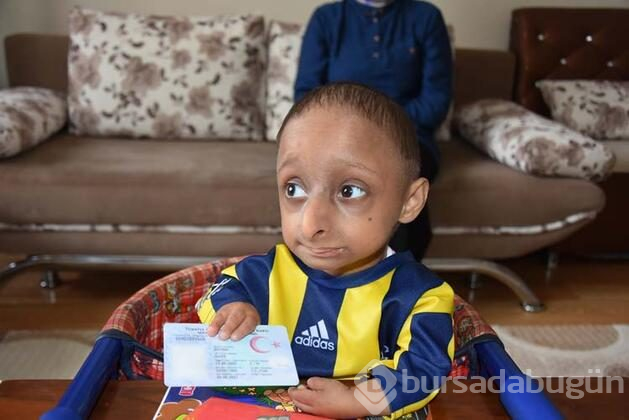 Türkiye'de bu hastalığı bulunan 3 kişi var