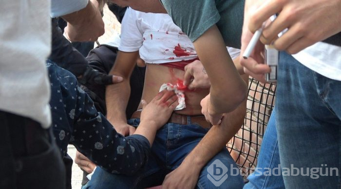 Denizli'de bıçaklanan şahıs görenleri şaşkına çevirdi