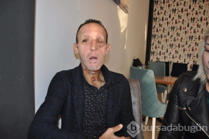Herkesi şaşkına çeviren gelişme!