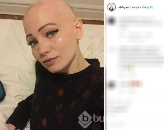 Hastalığını gizlemek için 6 ay boyunca bunu yapmak zorunda kaldı!