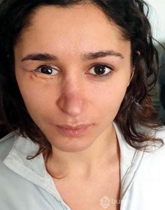 Genç kadın k&acirc;busu yaşamıştı!