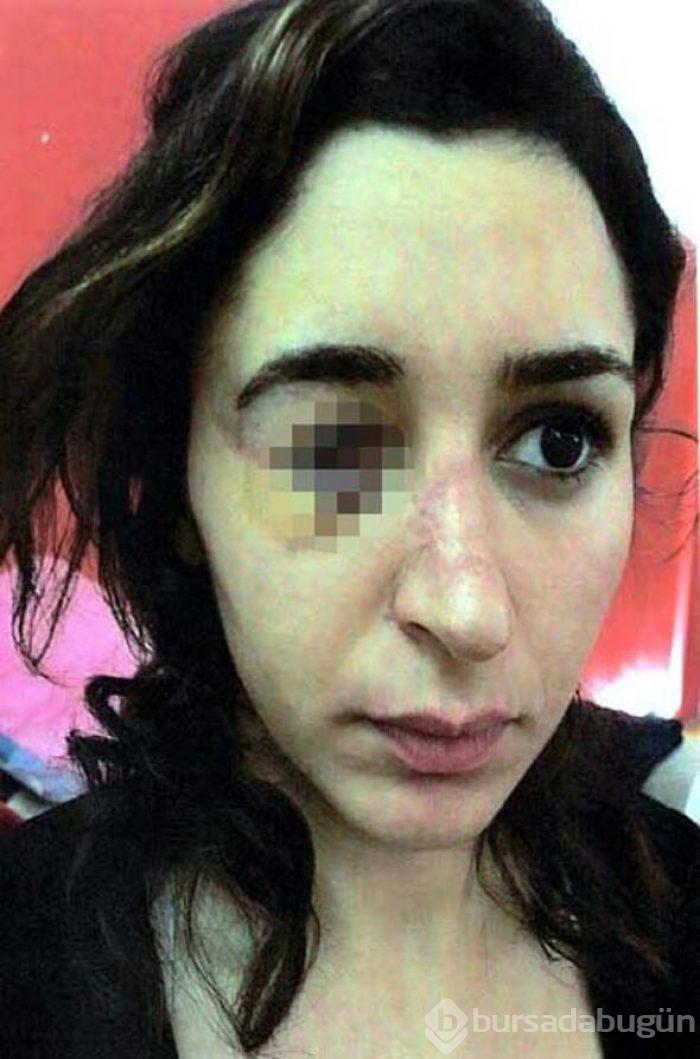 Genç kadın k&acirc;busu yaşamıştı!