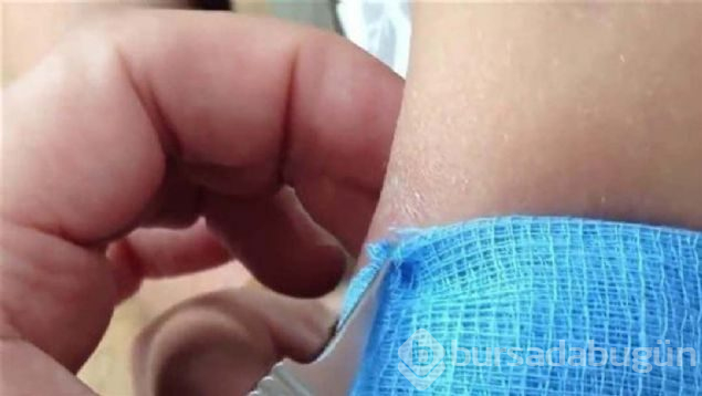 Yaranın içinden çıkanlara kimse inanamadı!