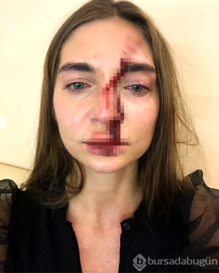 Rus şarkıcı, doktorunun saldırısına uğradı!