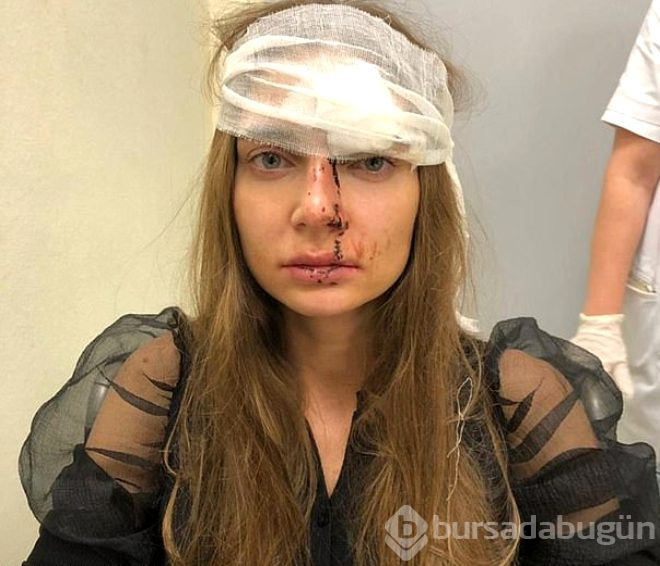 Rus şarkıcı, doktorunun saldırısına uğradı!