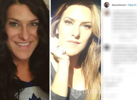 Çenesi, burnu, elleri ve ayakları büyüdü!