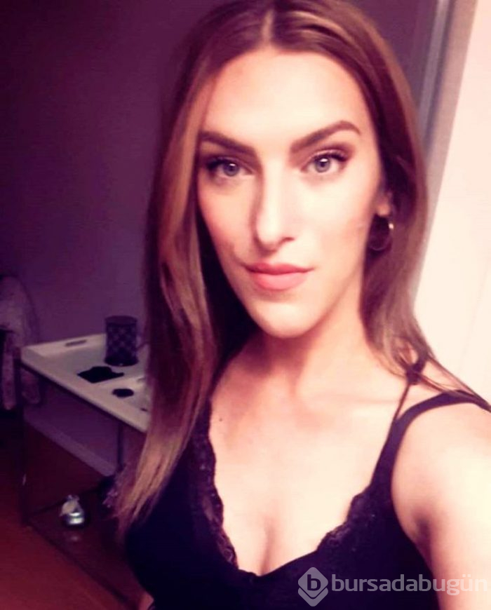 Vücut uzuvları durmadan büyüyor, çirkinleşiyordu!