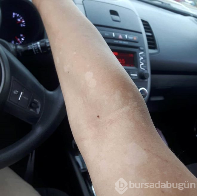 Vücut uzuvları durmadan büyüyor, çirkinleşiyordu!
