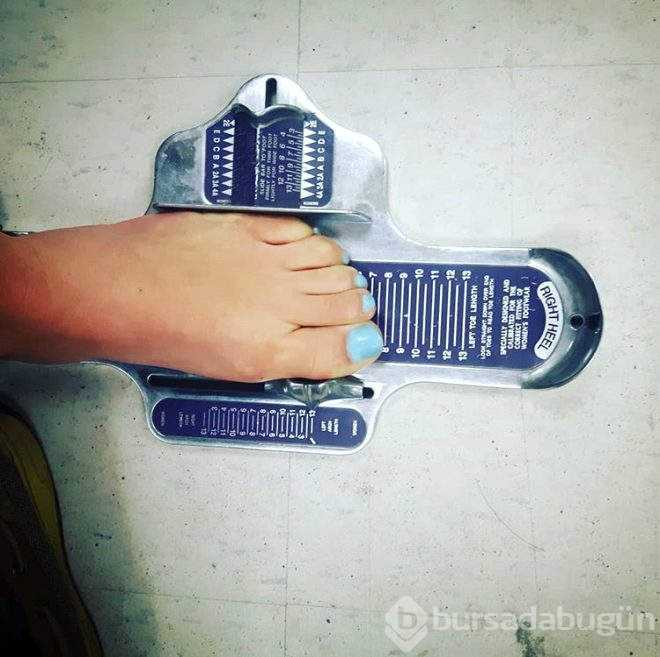 Vücut uzuvları durmadan büyüyor, çirkinleşiyordu!