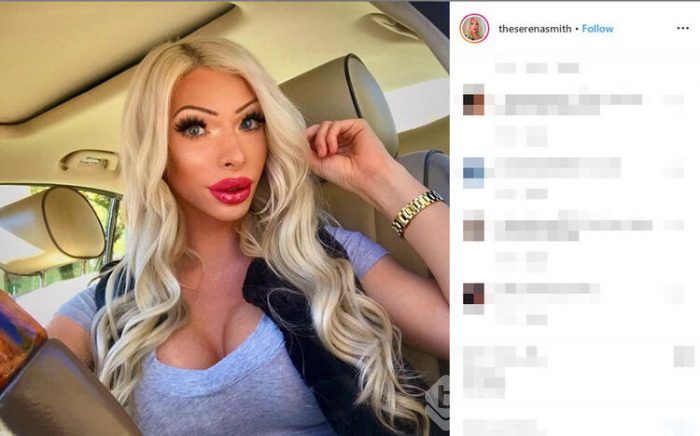 Yaptırdığı estetiklerle bambaşka birine dönüştü