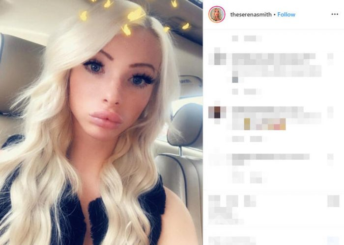 Yaptırdığı estetiklerle bambaşka birine dönüştü